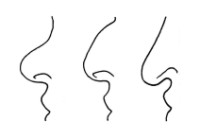 m&ouml;gliche Nasenformen